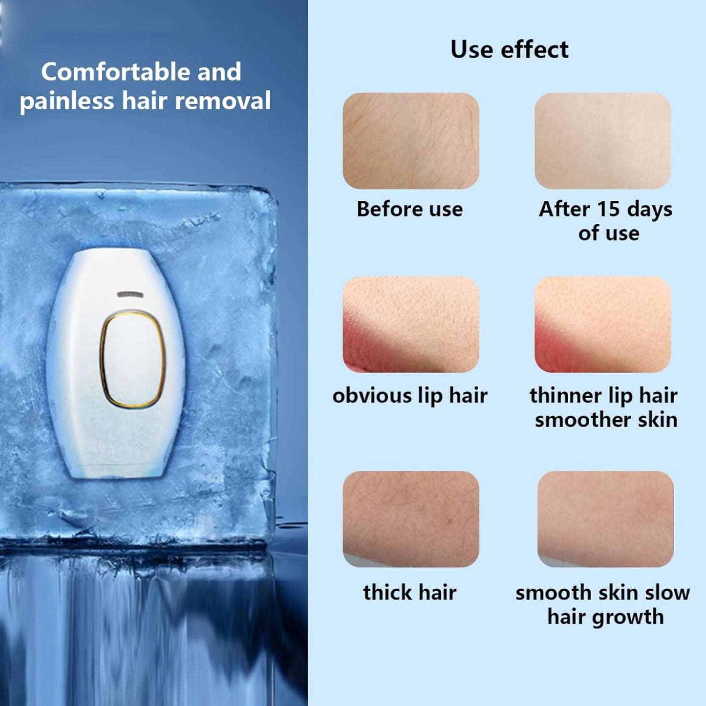 IPL Laser Hair Removal Handset – Painless Permanent Hair Reduction for Face & Body