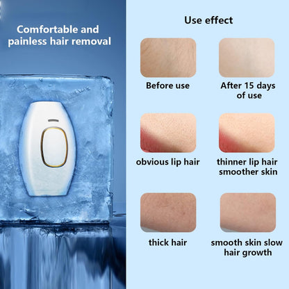 IPL Laser Hair Removal Handset – Painless Permanent Hair Reduction for Face & Body